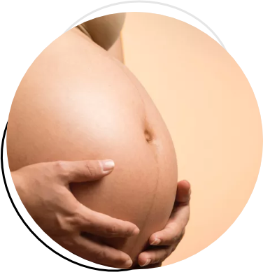 Abdominoplastia Após Cesárea Abdominoplastia Após Cesárea